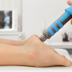 Non-Surgical Healing Solutions with ESWT Shockwave Treatment
